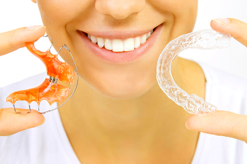 removable vivera retainers